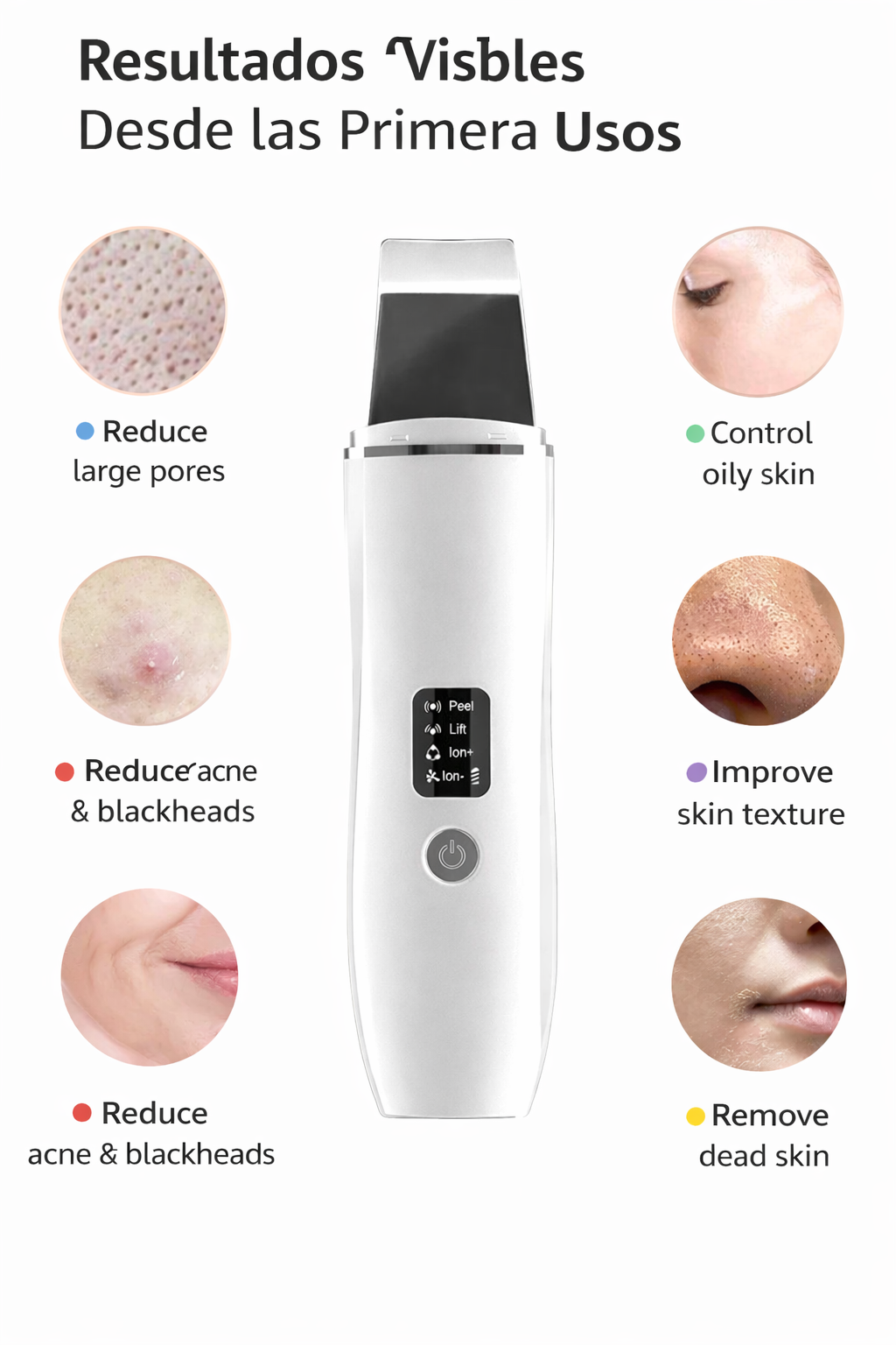 NOVΛ Care Ultrasonico para Piel,Limpieza Facial Profunda
